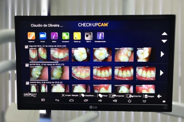 Fotografia de monitor com software de checkup digital em um consultório de dentista em demonstrando várias arcadas dentárias.