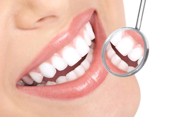 Foto do rosto de mulher branca sorrindo com um espelho de dentista de precisão mostrando os dentes.